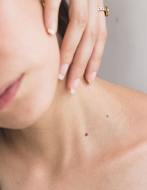 Skin Tag / Verruca Removal Beau Boutique Kent